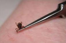 Image of a tick being removed with tweezers.