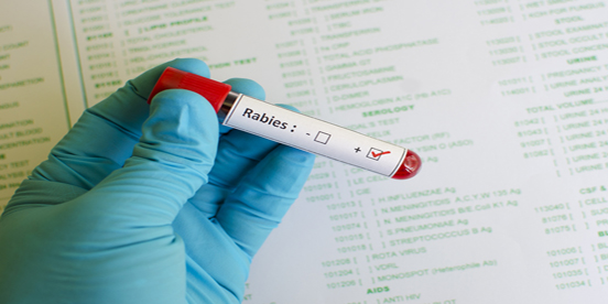 Rabies